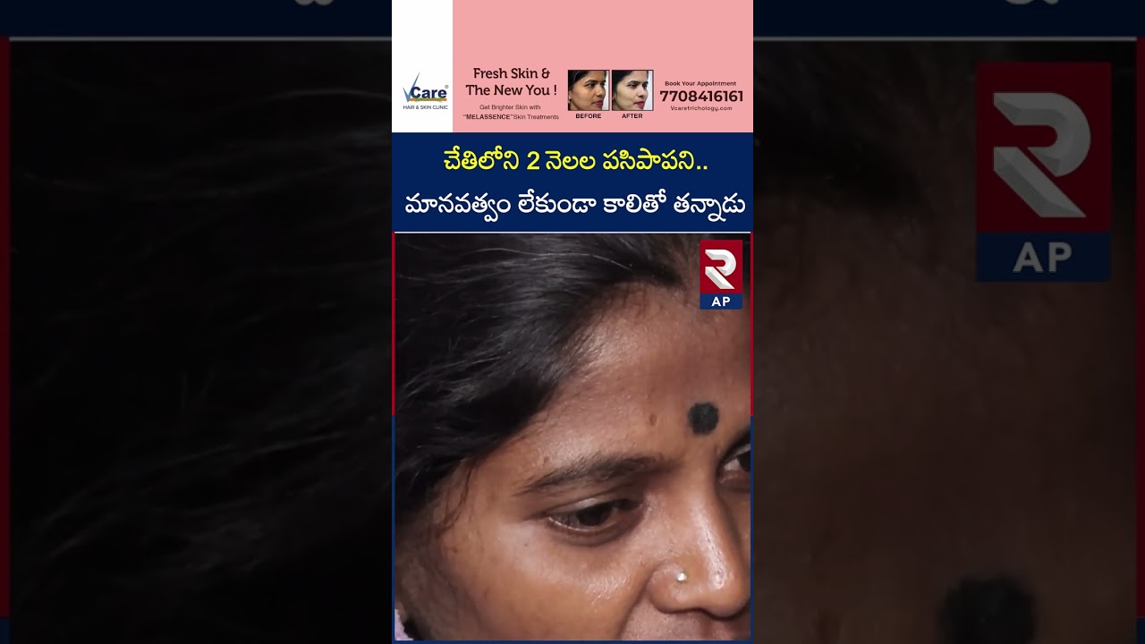 Mother Shocking Facts About Kummera Incident | RTV AP
