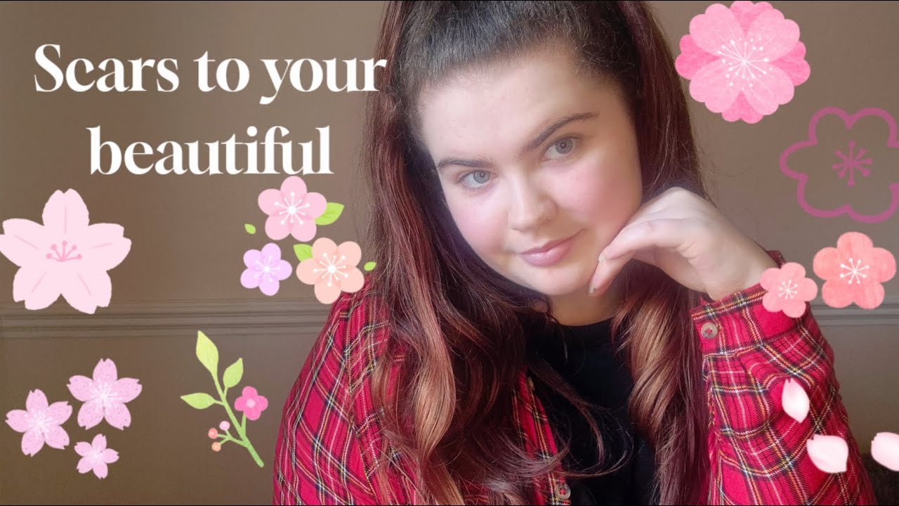 Scars to your beautiful, Alessia Cara cover by Leah Waller-Hill