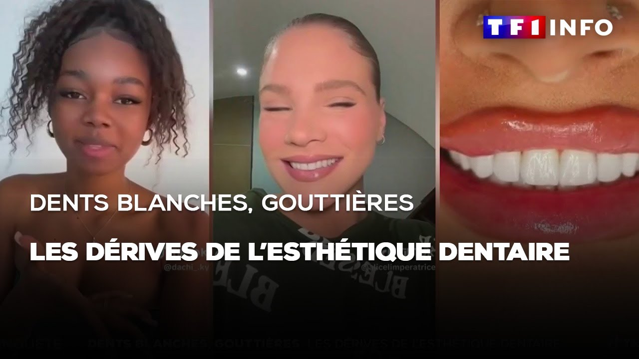 Dents blanches, gouttières : les dérives de l'esthétique dentaire