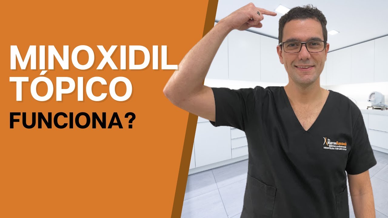 Uso de Minoxidil t&oacute;pico, funciona?