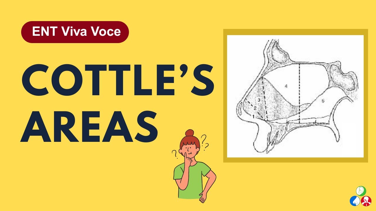 Cottle’s Areas | ENT Viva Voce