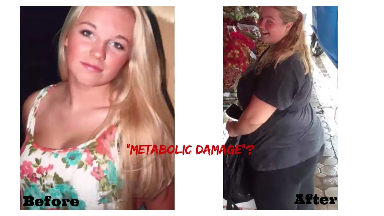 Before and After 