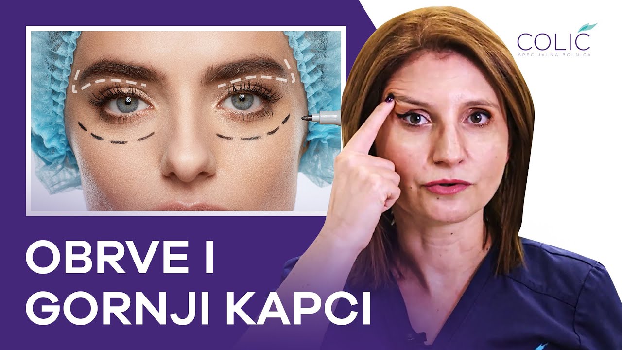 Da li spuštene obrve dodatno spuštaju kapke? | Podizanje obrva | Operacija kapaka