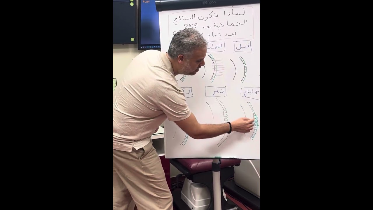 لماذا تكون النتيجة النهائية بعد تصحيح البصر السطحي PKR بعد 3 أشهر؟