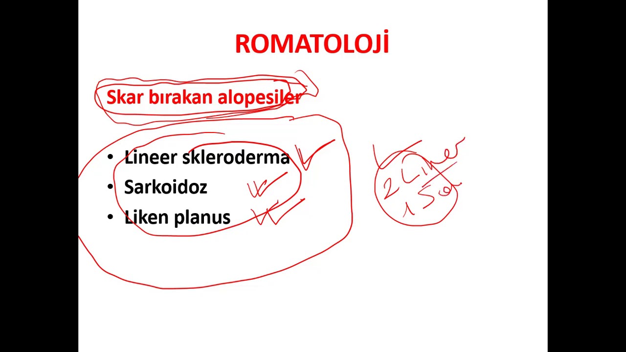 TUS EKİM 2020 İÇİN DAHA ÖNCE SORULMAMIŞ KONULAR ve AÇIKLAMALARI-TUS SINAVI