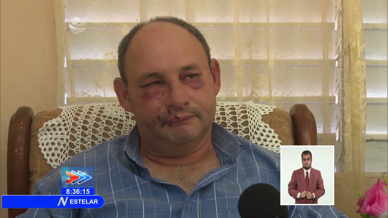 Cuba: Testimonio de dos agredidos durante disturbios del 11 de julio en Camagüey