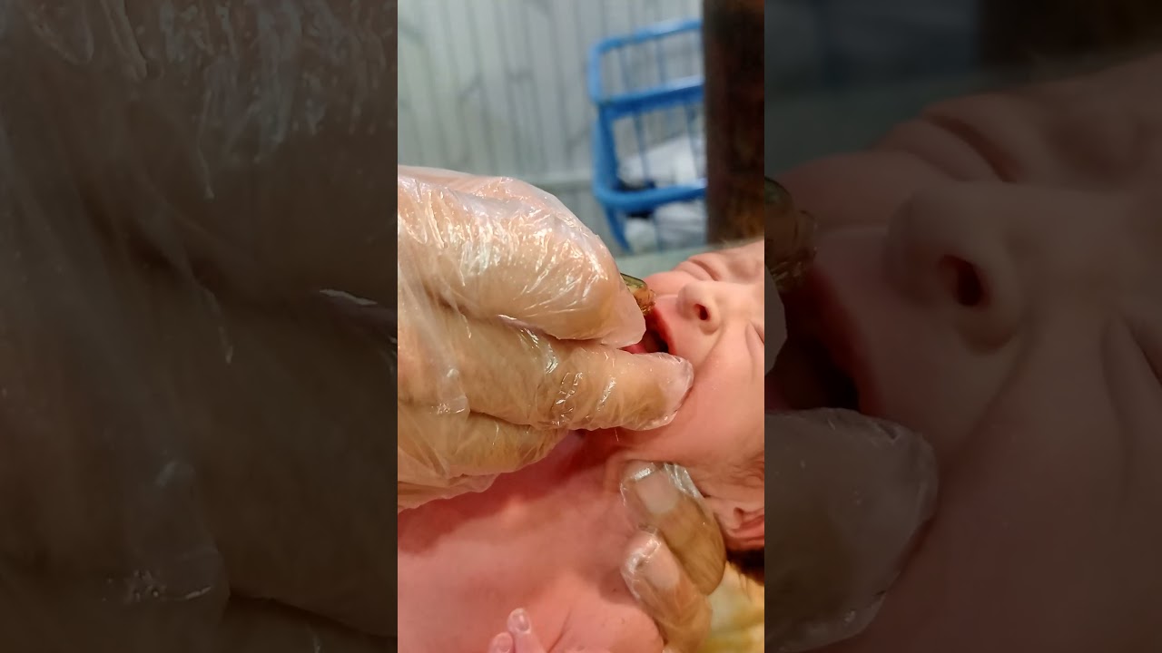 Newborn Care: Oral Vitamin K Administration #premature #newbornbaby #neonatologist #nicunurse #baby