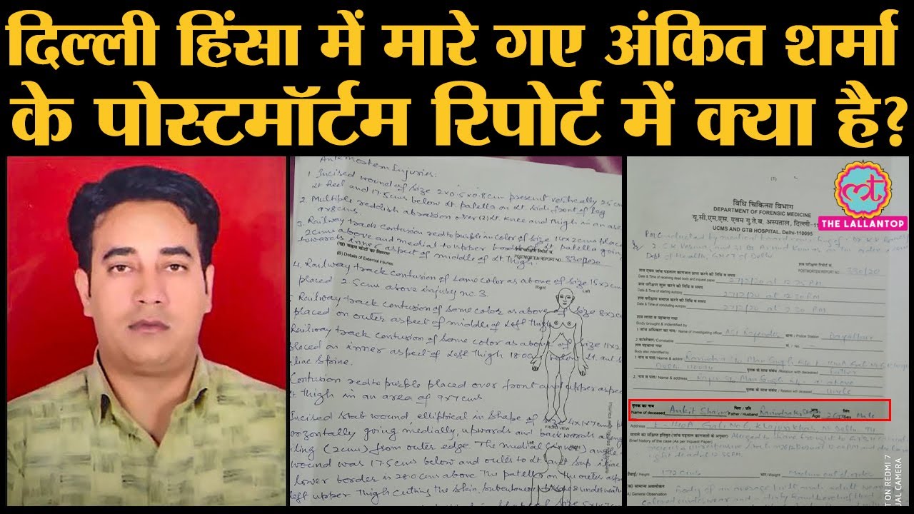 Delhi violence: IB के Ankit Sharma की postmortem report| Amit Shah |Delhi riots