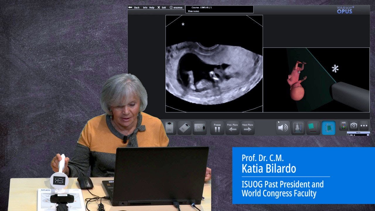 Prof. Dr. C.M. Katia Bilardo’s ISUOG 2022 Webinar