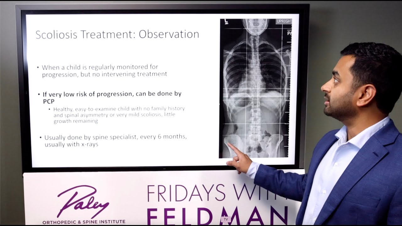 Fridays with Feldman | What is Scoliosis? Symptoms, Diagnosis, and Treatment Options