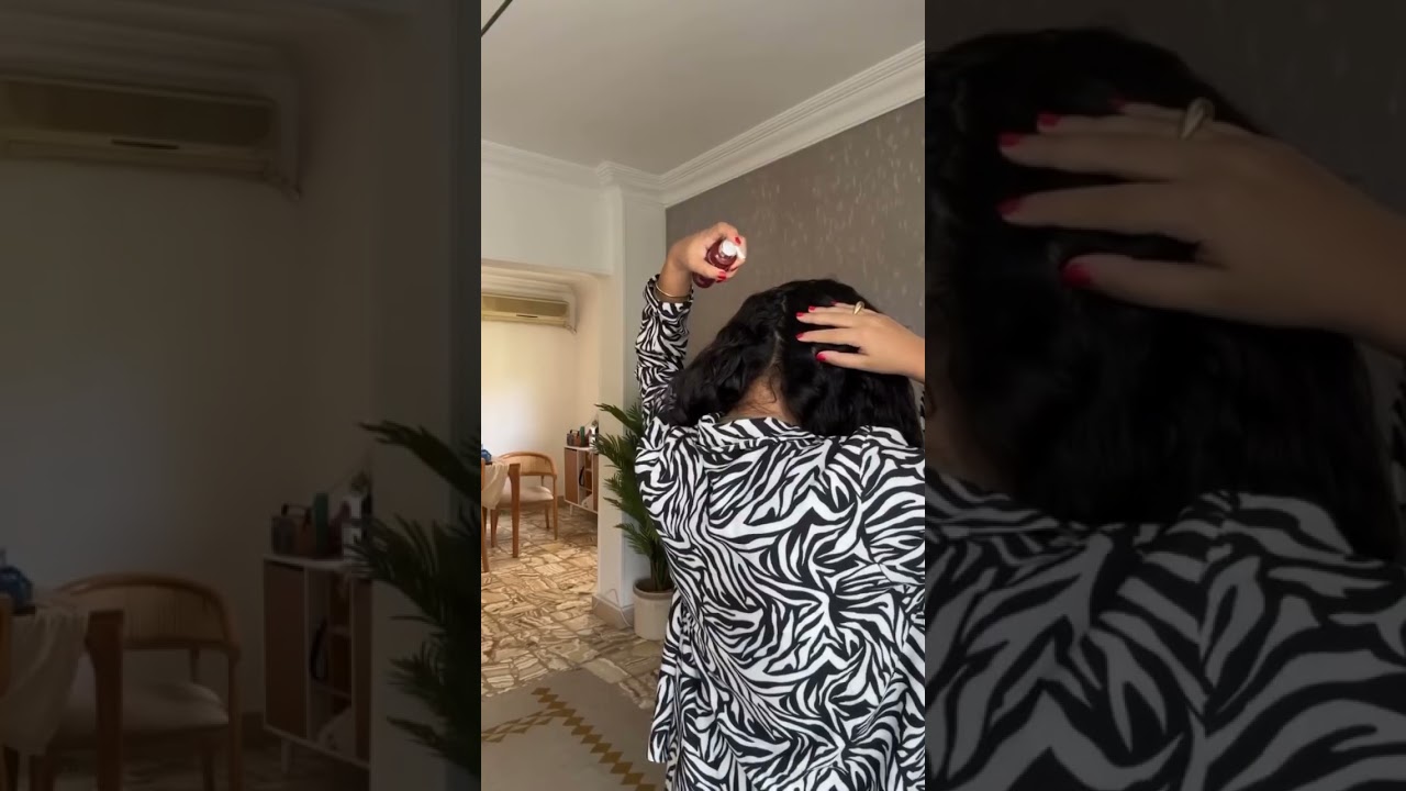 بديل آمن للمينوكسيديل، من غير أعراض جانبية، ومن غير تعقيد.