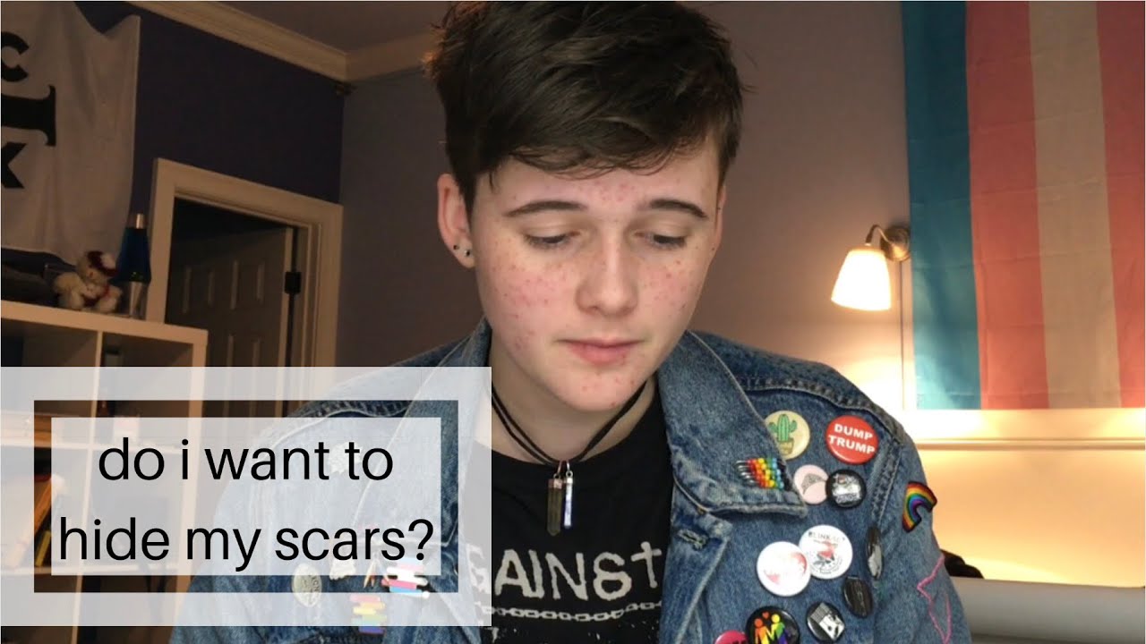 tattooing over my self-harm scars?