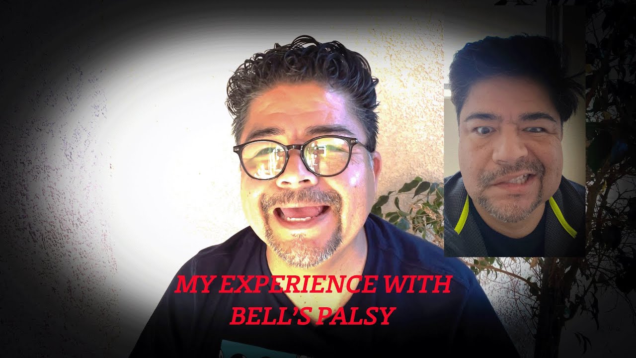 How I recovered  from Bell's Palsy  in three weeks!
