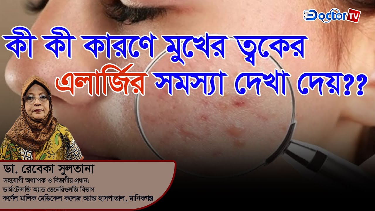রোগী জেনেও জানেনা কেন মুখের ত্বকে এলার্জি হয় ║ ডা. রেবেকা সুলতানা Rabaka Sultana