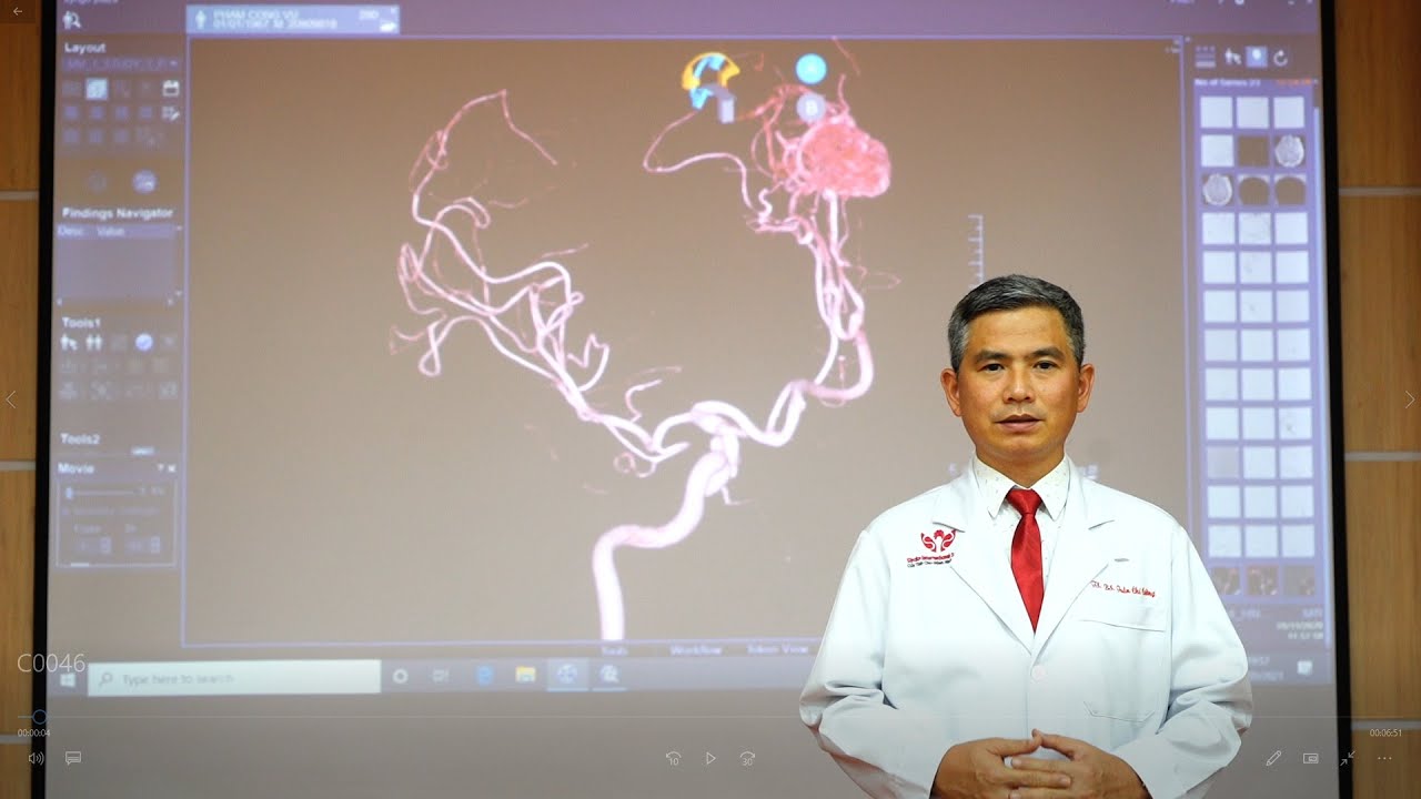 Những dấu hiệu Đau Đầu cần chú ý