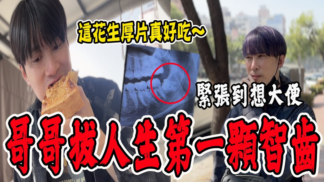 哥哥拔人生中第一顆智齒！緊張到想大便！皺眉說比探險還恐怖！【VLOG】《國王KING》ft.未來男友Liann 果果