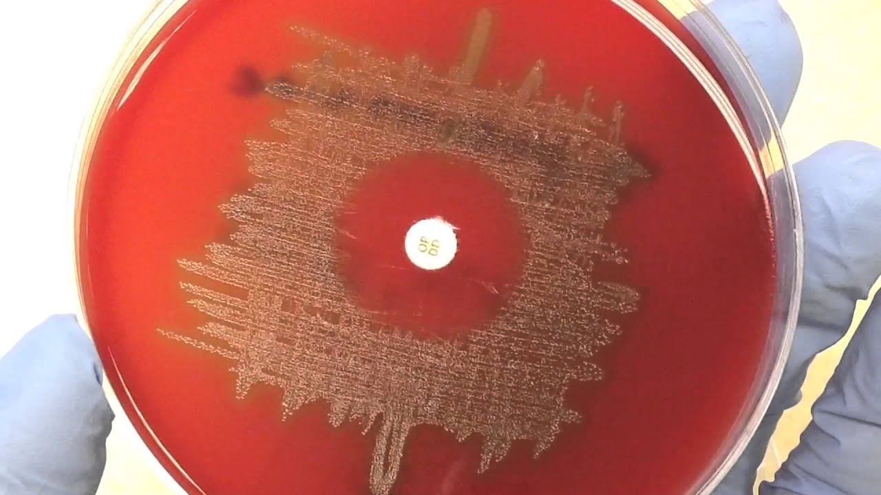 Microbiology - Optochin