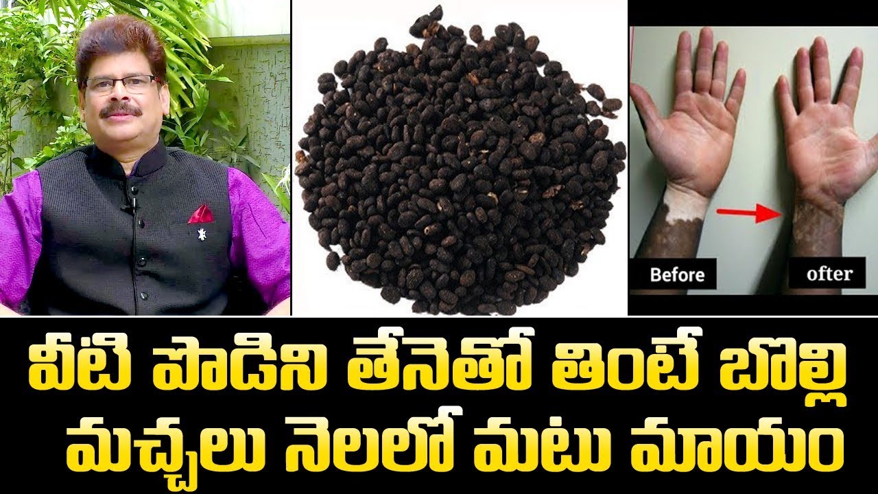 వీటి పొడిని తేనెతో కలిపి తింటే బొల్లి మచ్చలు నే రోజుల్లో మటు మాయం || Health Benefits Of Bavanchal