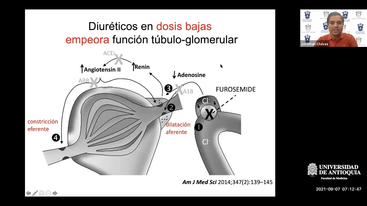 Descongestión Vascular con Diuréticos en Síndrome Cardiorrenal 1 - Dr. Jonathan Chávez
