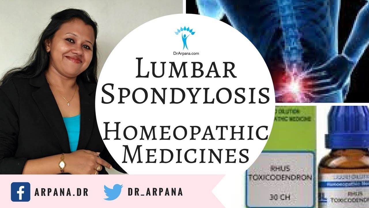 लम्बर स्पोंडिलोसिस के कारन व होम्योपैथिक इलाज || LUMBAR SPONDYLOSIS Best Homeopathic Medicines