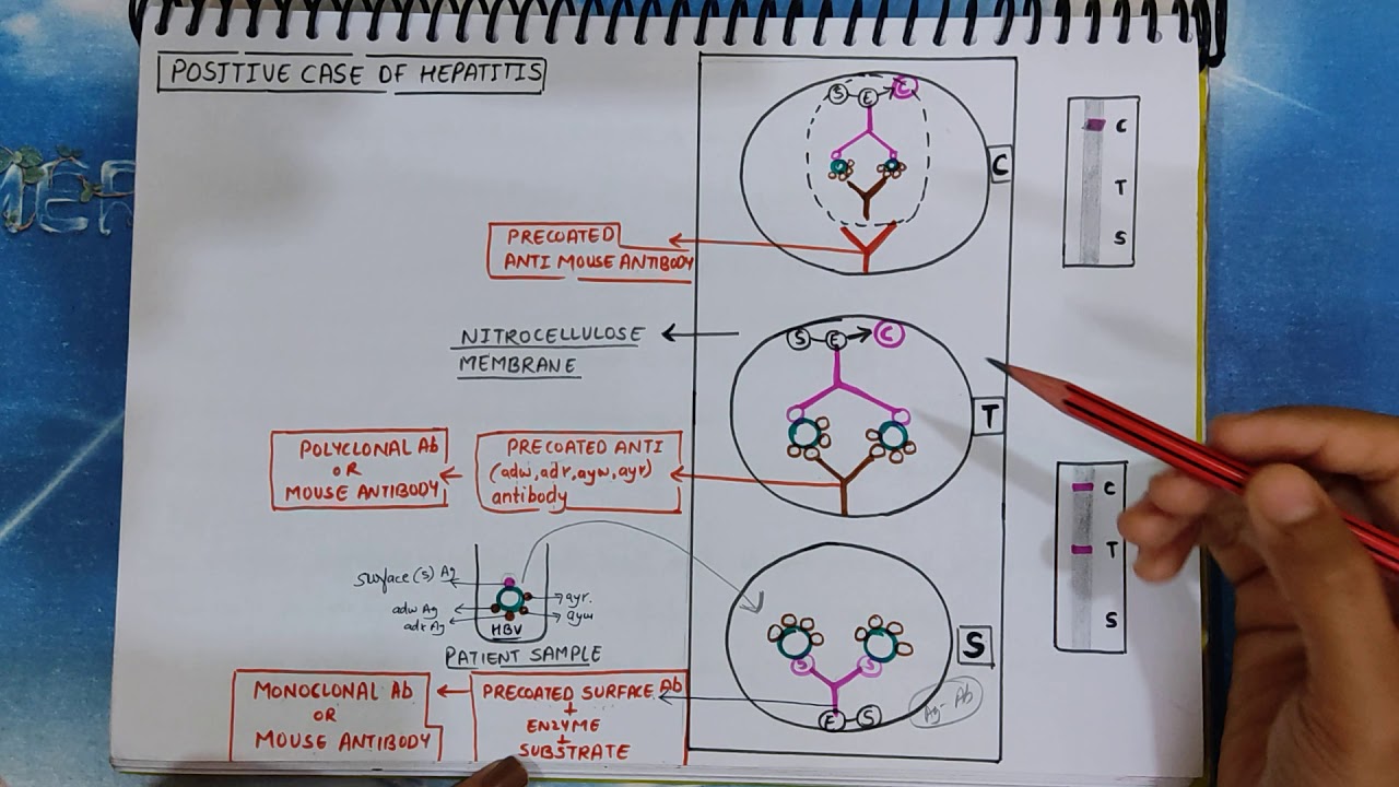HEPACARD TEST | Rapid test for hepatitis B Virus| Principle | Procedure | Result | Interpretation