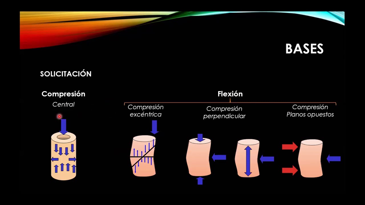 Biomecánica de la Fijación de las Fracturas