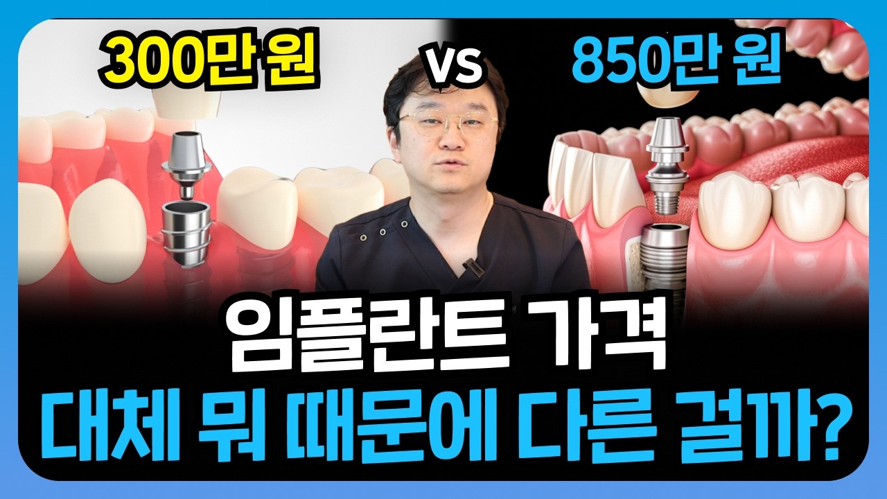 300만 원에 풀아치 임플란트 가능하다? 제발 속지 마세요 ㅠㅠ (비용, 가격 총정리)
