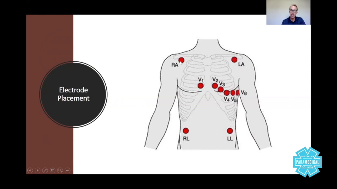 12-Lead ECG Acquisition and Interpretation - Australian Paramedical College