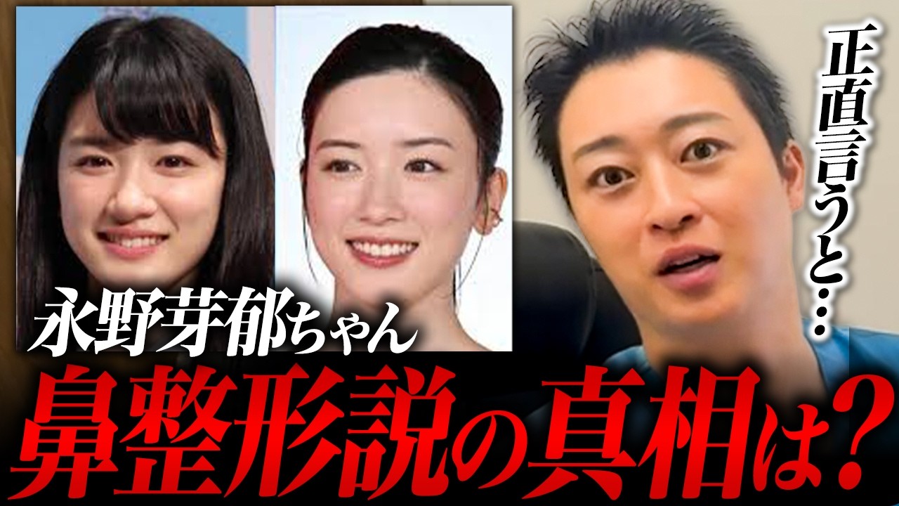 永野芽郁ちゃんは鼻整形やってる？話題の整形疑惑を美容ドクターが徹底解説！