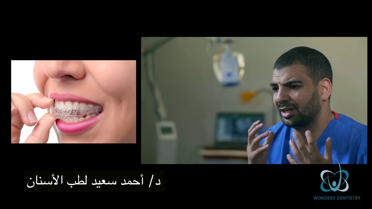 لو بتفكر في تقويم الأسنان لازم تشوف الفيديو دة، كل حاجة عن تقويم الاسنان