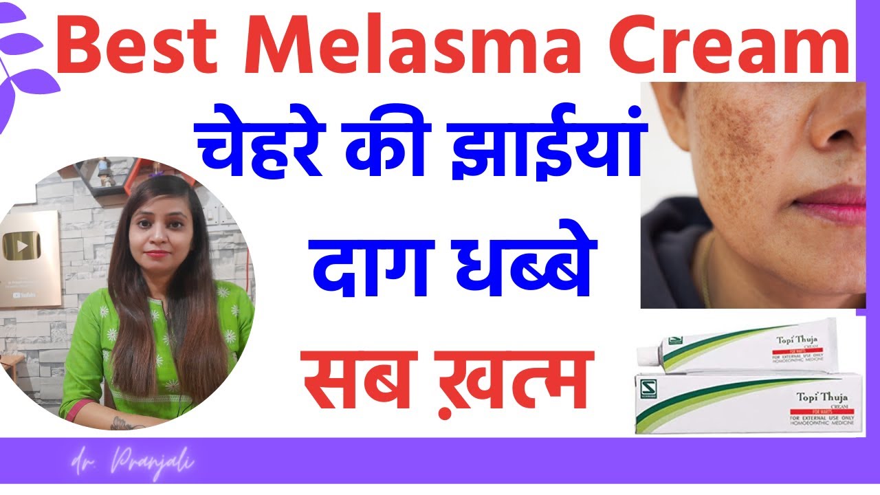 Melasma treatment | melasma cream | jhaiya khatam karne ka tarika | jhaiya khatam karne ki cream