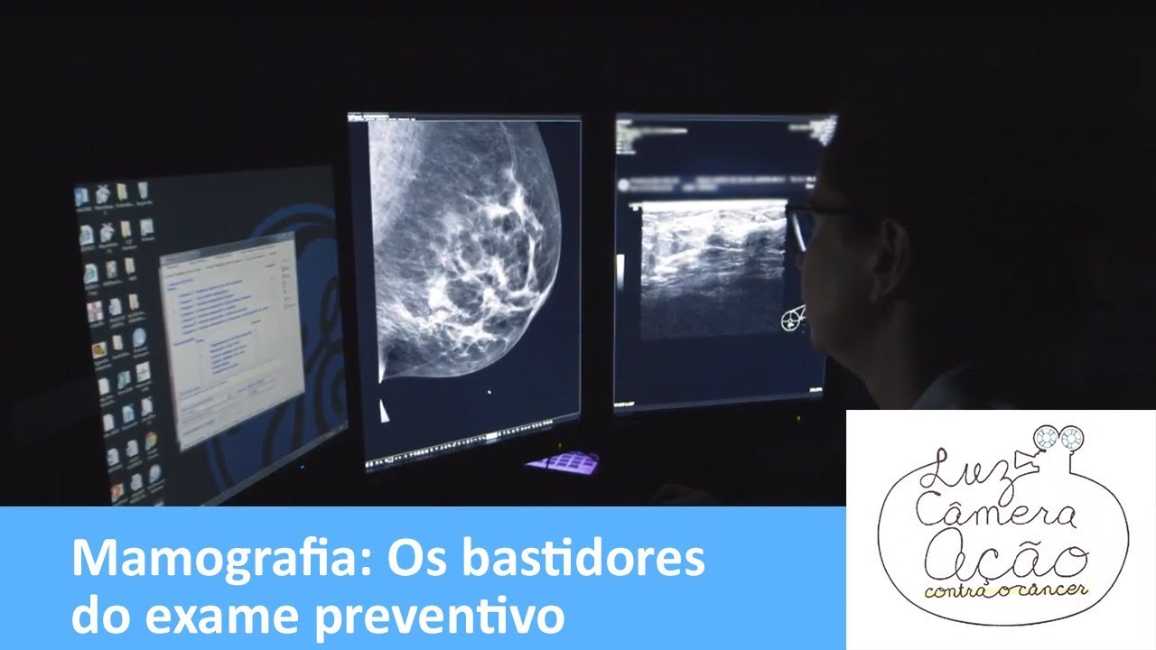 Luz, Câmera e Ação - 5/2/2018 - Mamografia: os bastidores do exame preventivo