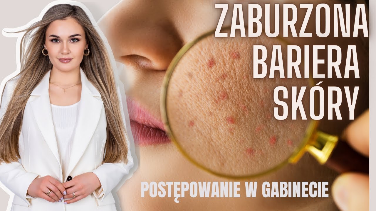 ZABURZONA BARIERA SKÓRNA - MOJE DOŚWIADCZENIA I PODEJŚCIE