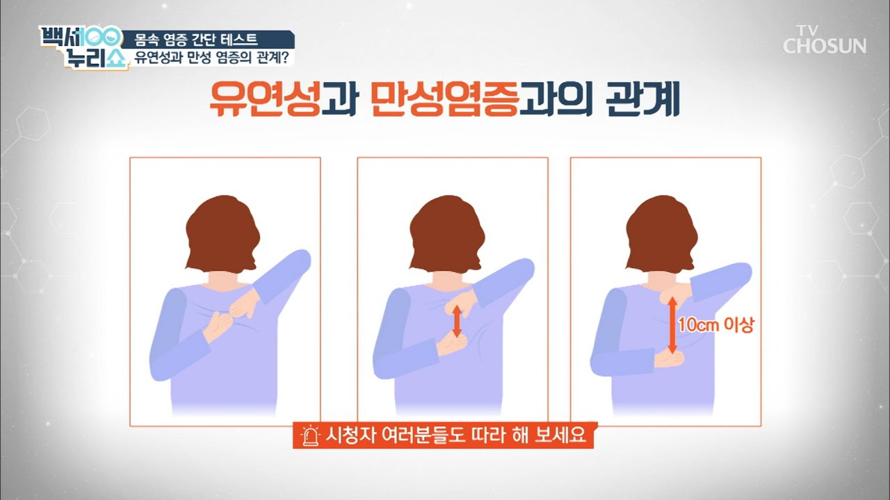 유연성으로 간단하게 알아보는 만성염증!| [백세누리쇼] 40회 | TV CHOSUN 20200916 방송