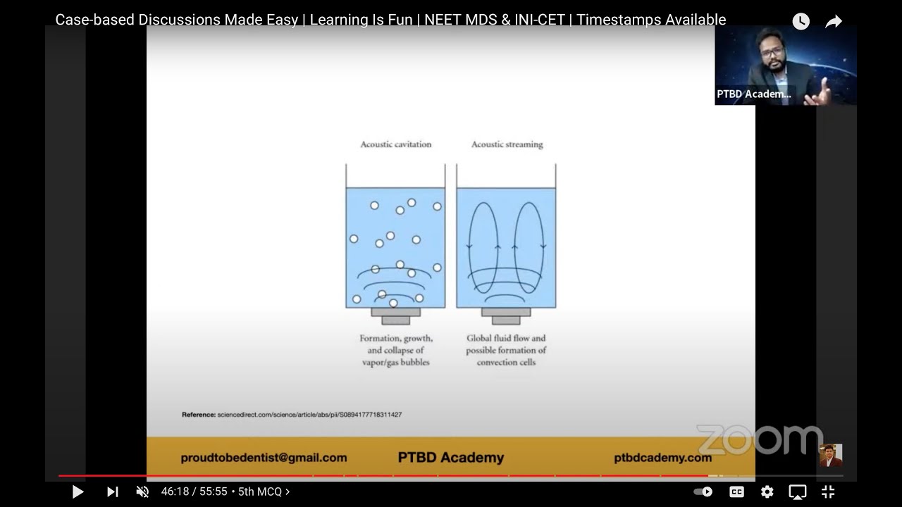Ultrasonic Scaling | Case-based Discussions Made Easy | Learning Is Fun | NEET MDS & INI-CET