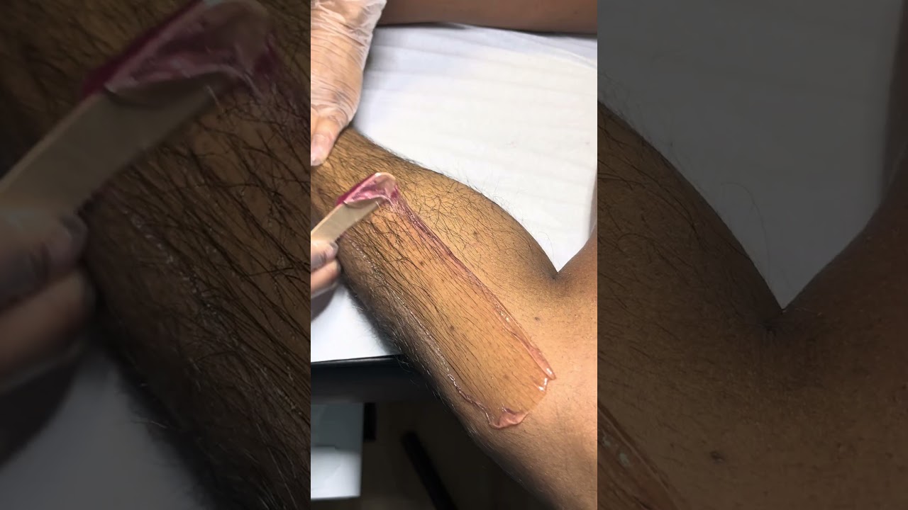 Full leg waxing with soft wax and strips #youtubeshorts #waxing #hairremoval #fyp #ingrownhair