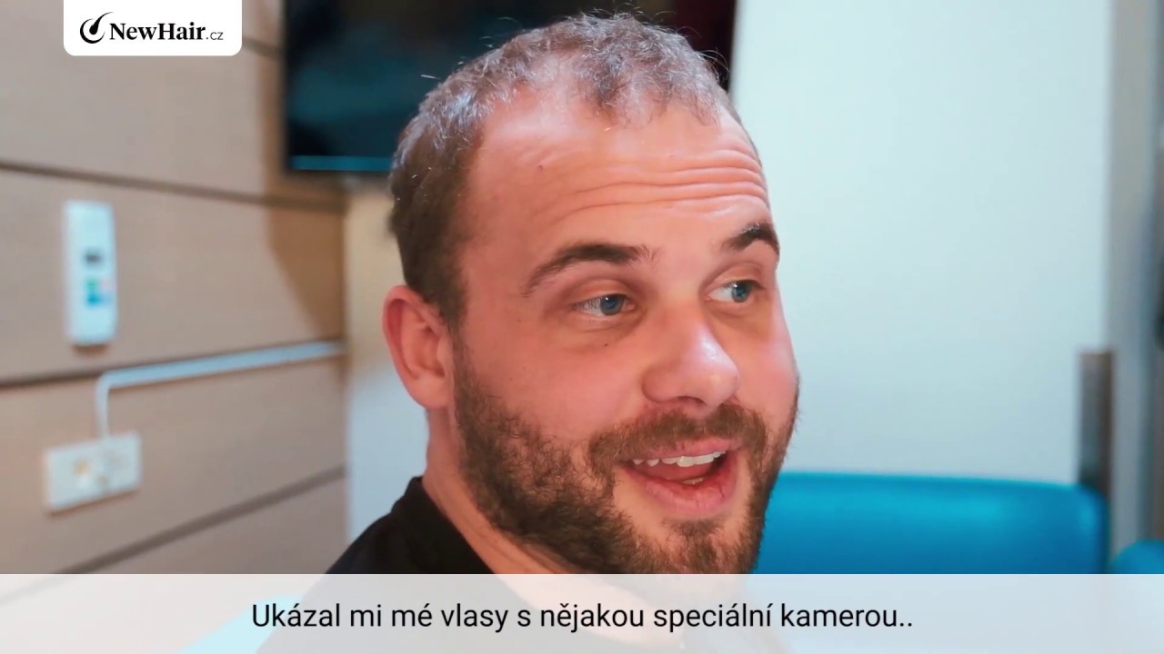 NewHair.cz - Do Turecka a zase zpátky: klientova cesta za vlasy