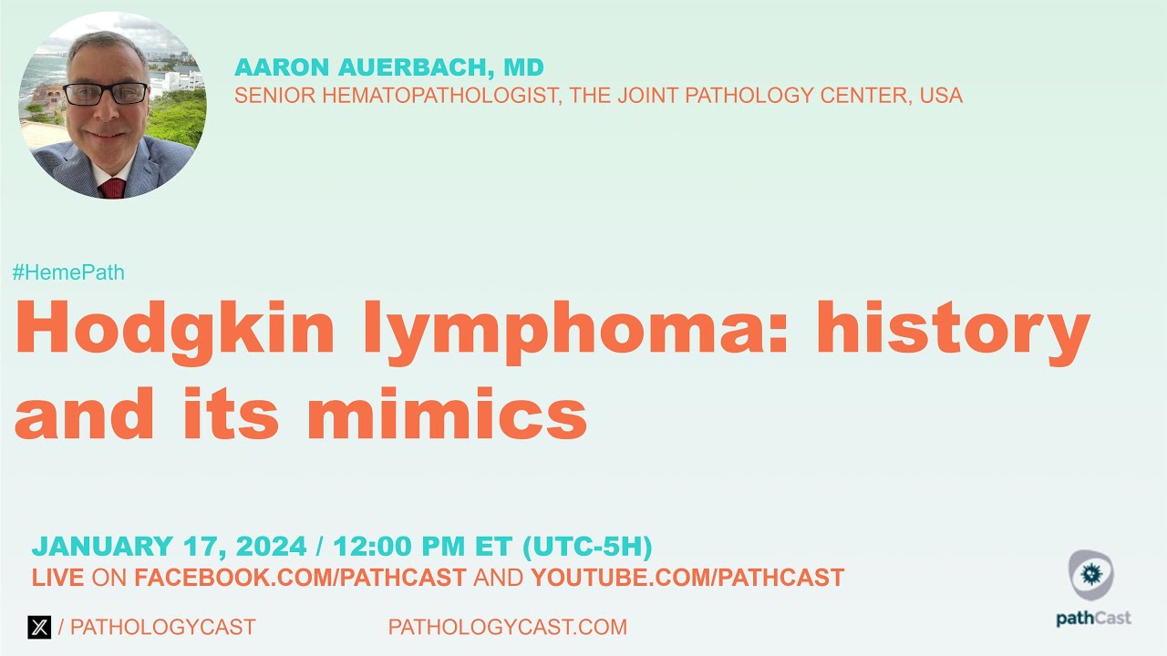 Hodgkin Lymphoma: history and its mimics