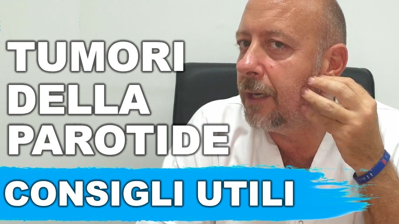Tumori della parotide: CONSIGLI UTILI