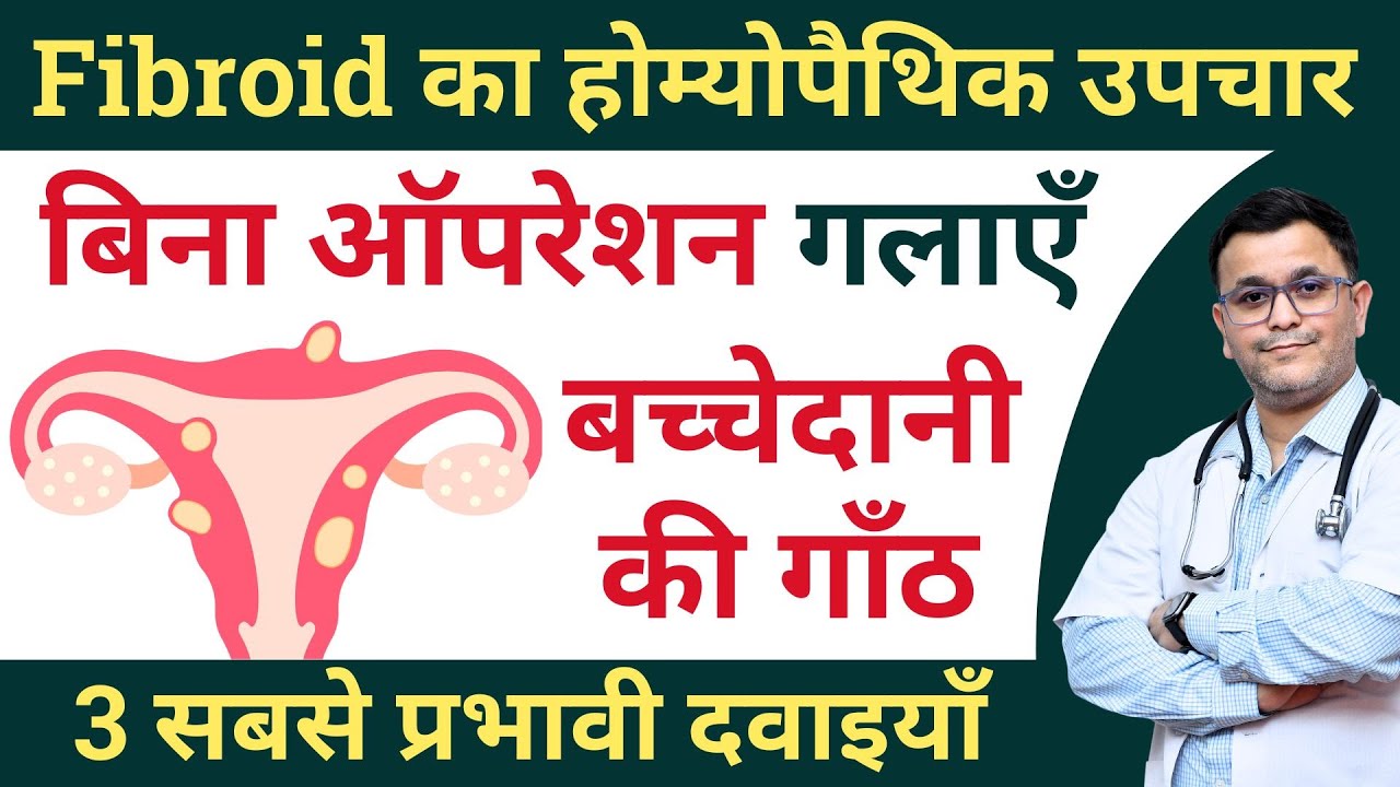 Uterine fibroid Homeopathic medicine Homeopathy treatment for Uterine Fibroids #RxHpathy