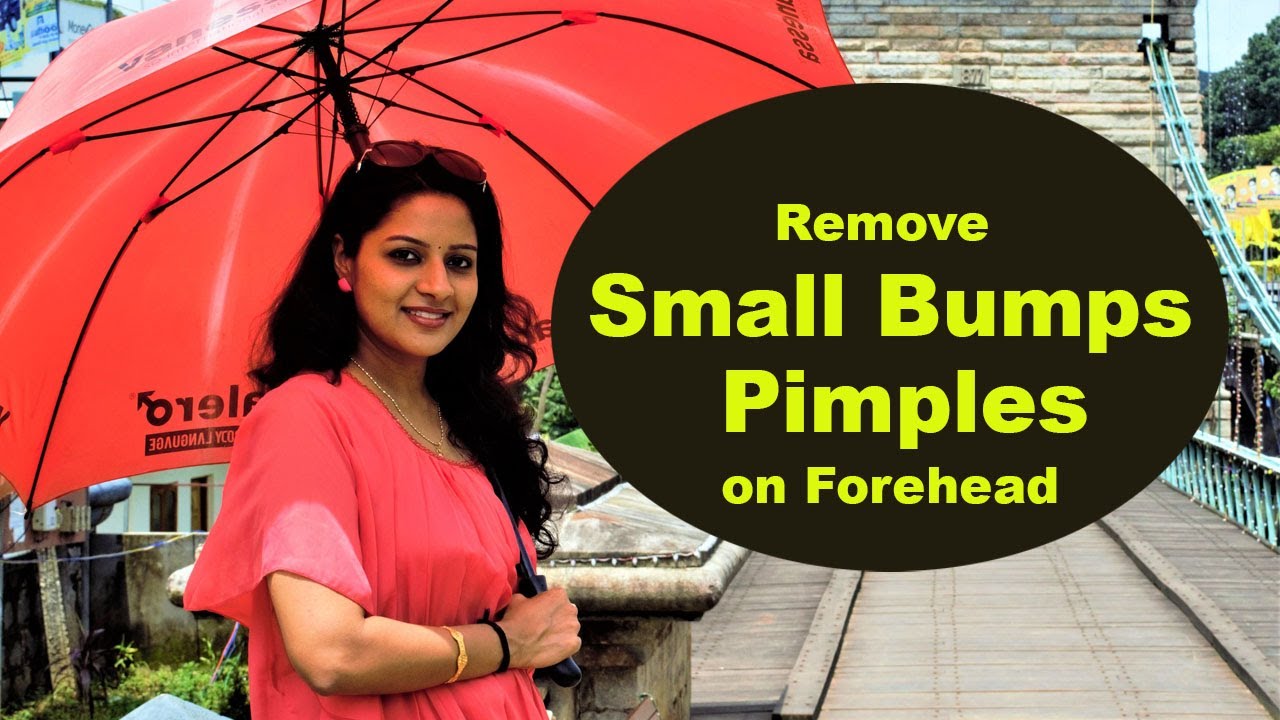 How to get rid of Small Bumps & Pimples on Forehead | Treat TINY BUMPS NATURALLY at home