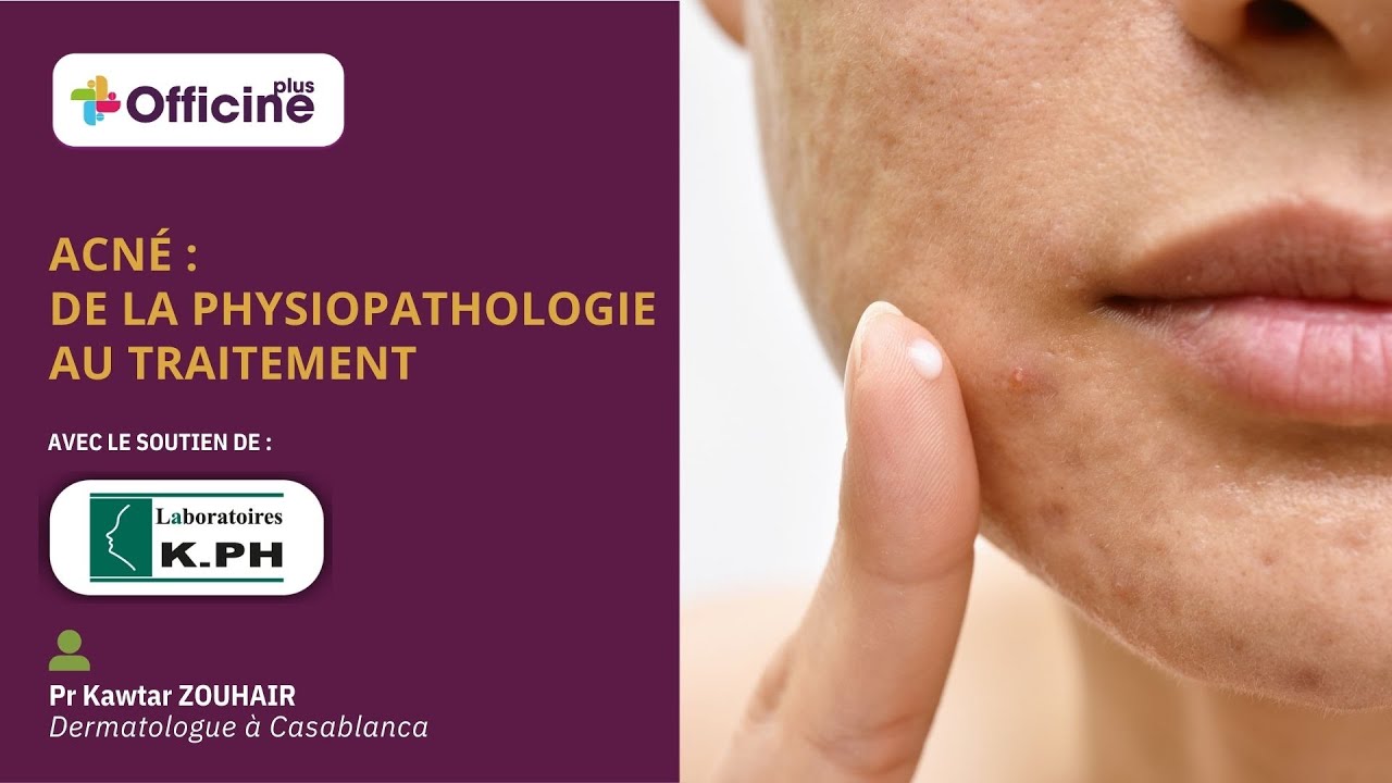 ACNÉ : DE LA PHYSIOPATHOLOGIE AU TRAITEMENT