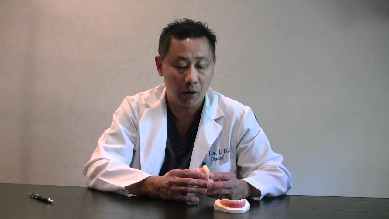 Complete Dentures-Advantages and Disadvantages, Toronto Dental Office