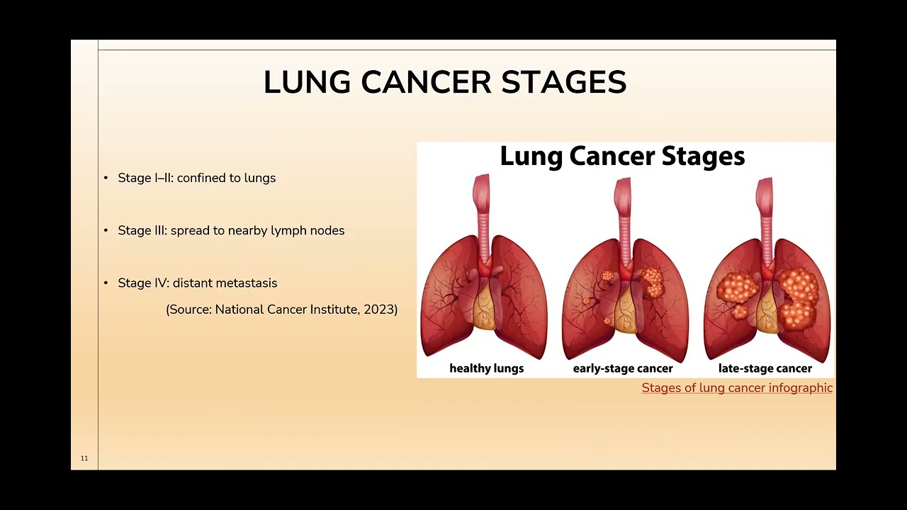PSA: Lung Cancer