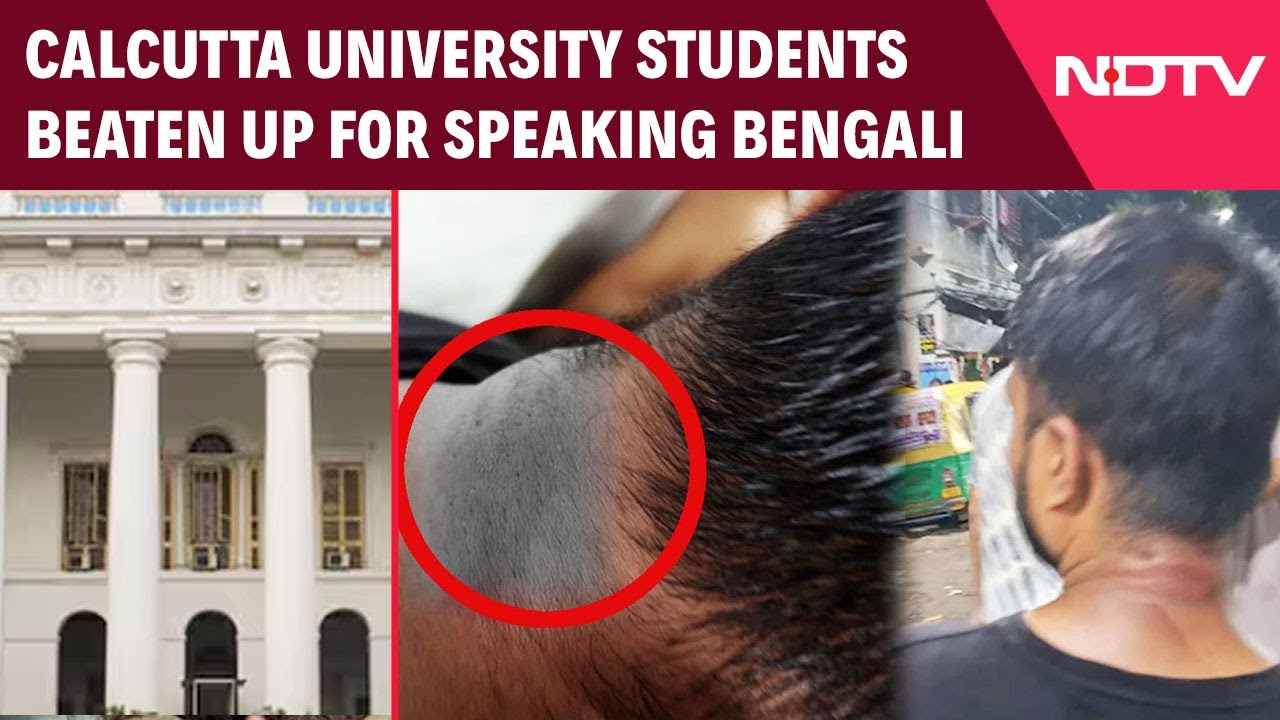 Kolkata News | Calcutta University Students Beaten Up For Speaking Bengali, Called 'Bangladeshis'