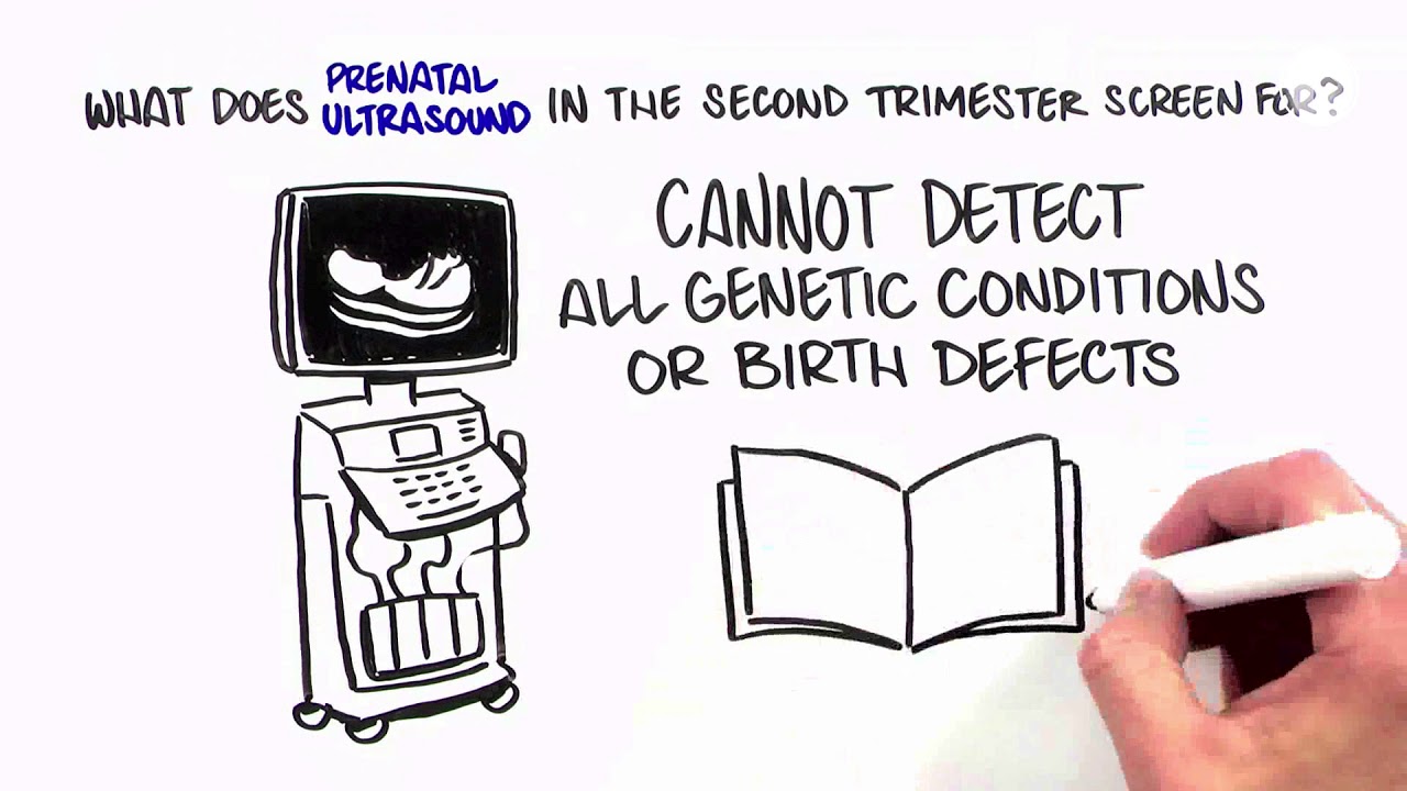 Prenatal Screening Options: Prenatal ultrasound