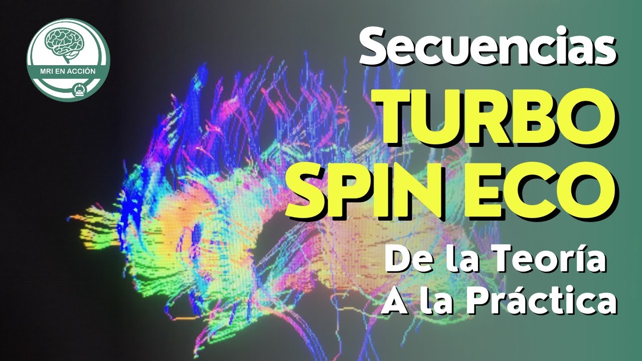 Balanceando la secuencia Turbo Spin Eco en Resonancia Magnetica.Video 3