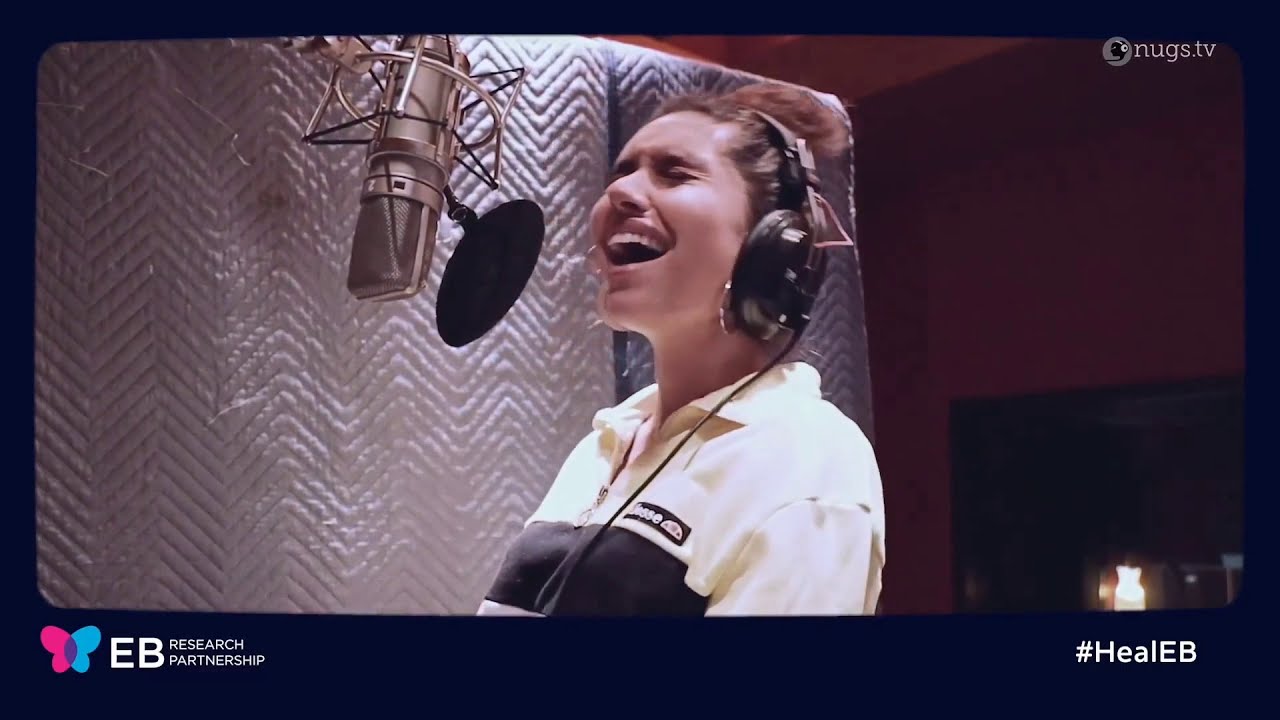 Alessia Cara - Scars To Your Beautiful (Acoustic Live for Venture Into Cures)