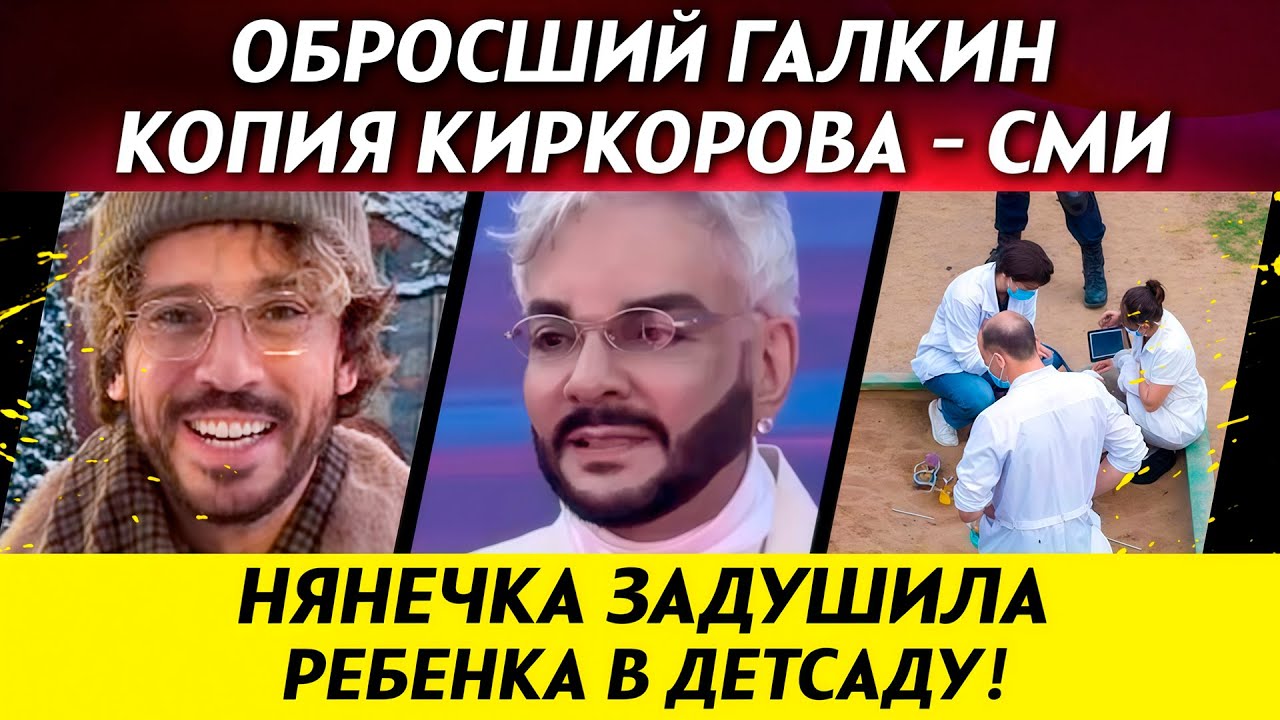 ДОЛИНА ПЕРЕЕХАЛА в особняк. Обросший Галкин - копия Киркорова. Народ обожает Дмитриенко | НОВОСТИ