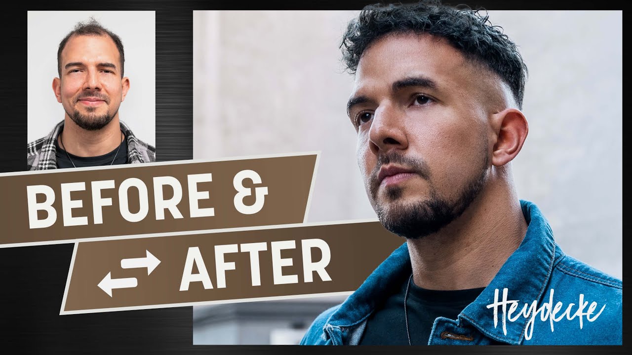 Goodbye to bald spots | On-trend curly hairstyle with a hairsystem